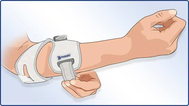 Anlegeanleitung Masalo Manschette MED - Verschließen der Unterarmmanschette