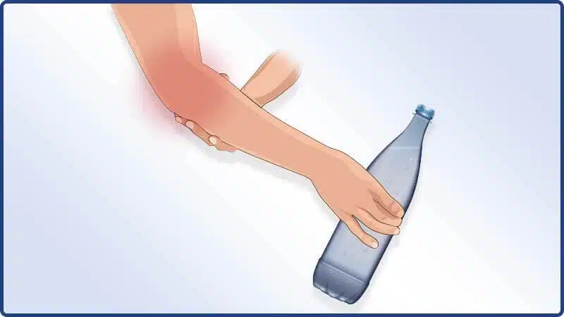 Funktionstest der Masalo Manschette mit einer PET Flasche