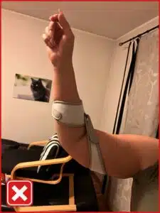 Anlegehilfe Masalo Manschette MED - Beispielbild 1 für Masalo Manschette falsch angelegt - Gurt zu weit nach oben in Richtung Schultern gezogen